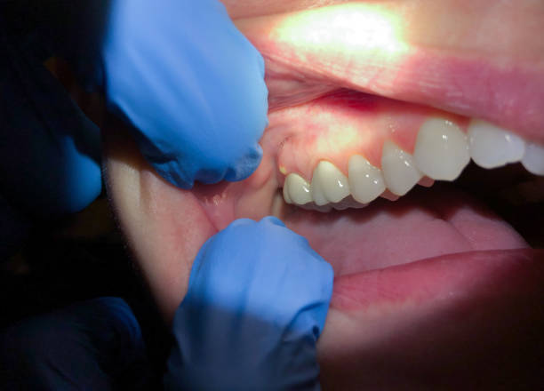 Best Emergency Treatment for Jaw Pain or Injury in Fern Prairie, WA