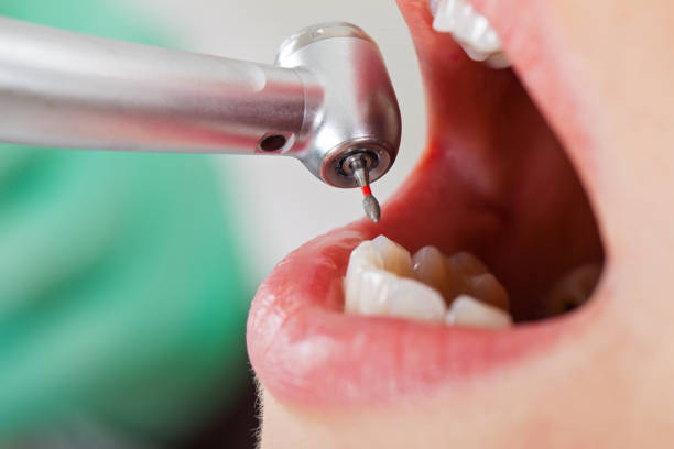 Best Emergency Pediatric Dental Care in Fern Prairie, WA